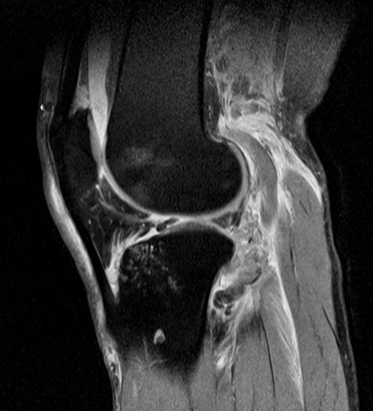 Figure 5 for case arcuate sign
